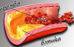 Фото: Сосудистая эректильная дисфункция