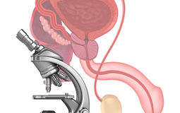 Фото: Эректильная дисфункция, лечение в Санкт Петербурге